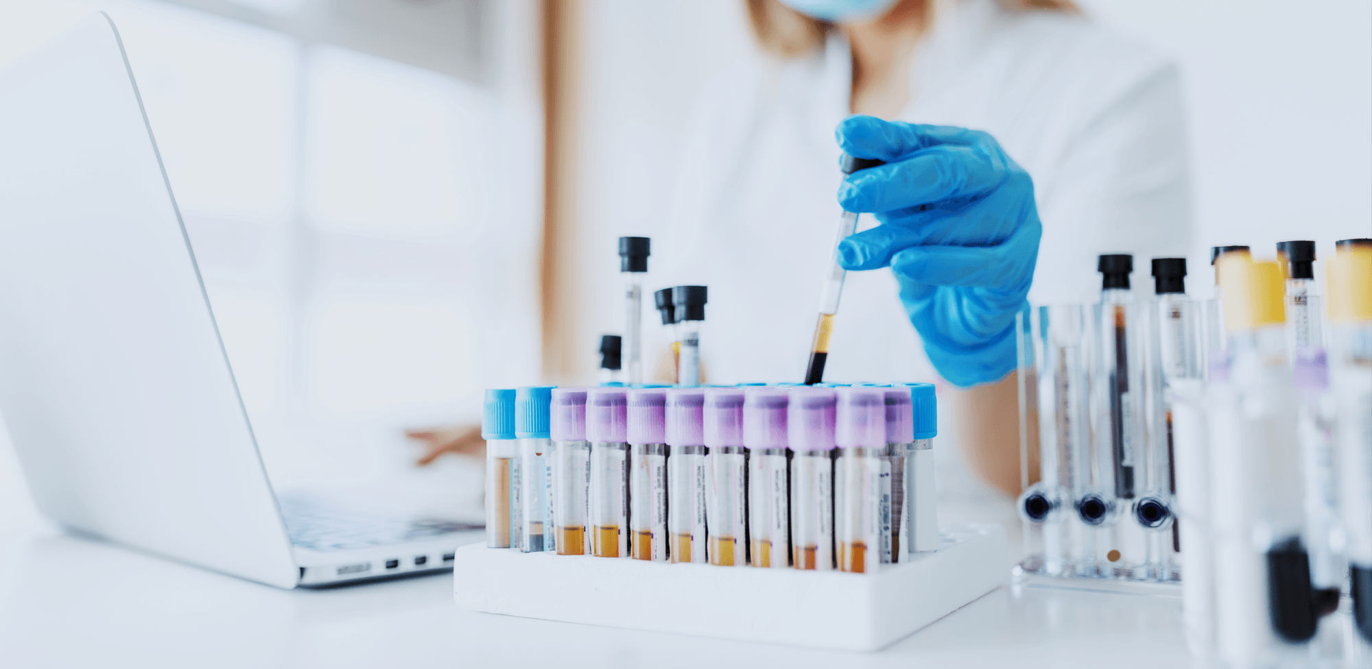 Does 7OH Show Up on a Drug Test? A Clear, Friendly Guide to What’s Actually Detected